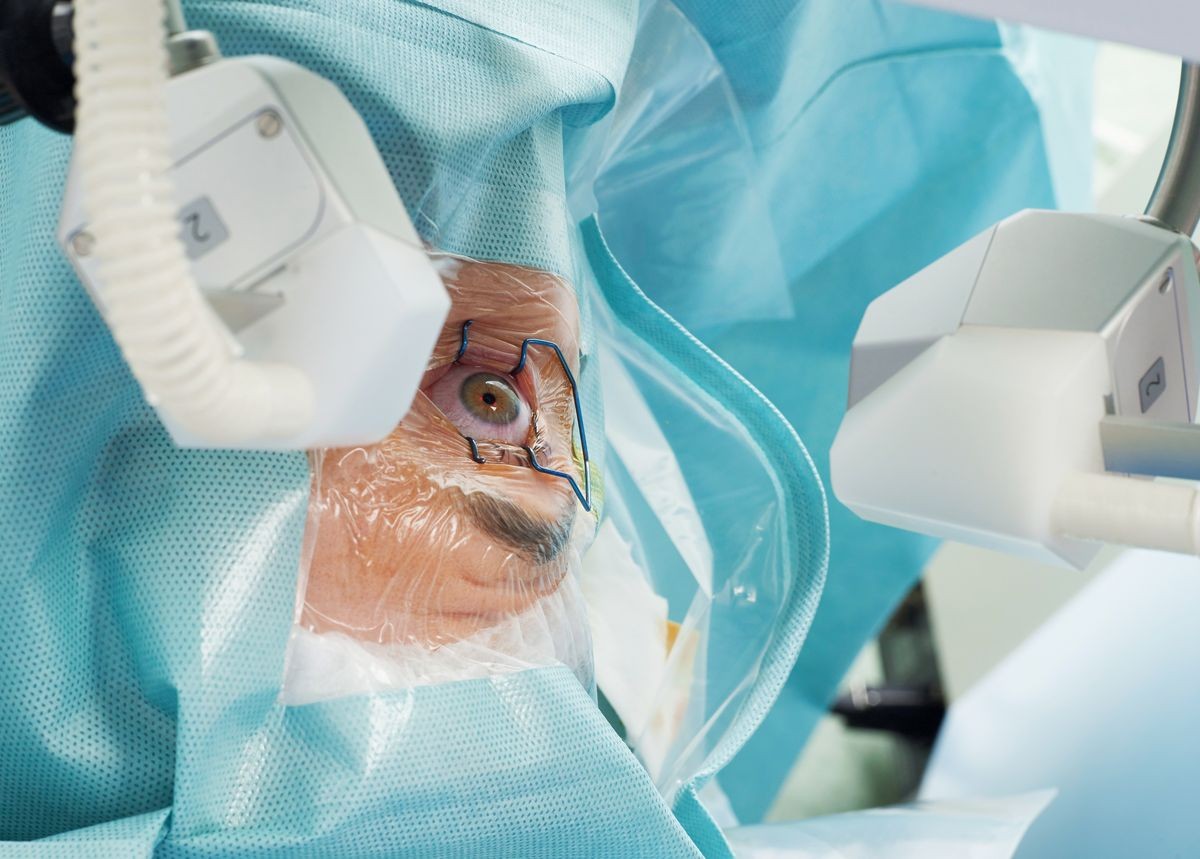 Experts in LASIK, Cataract, Retina Surgeries